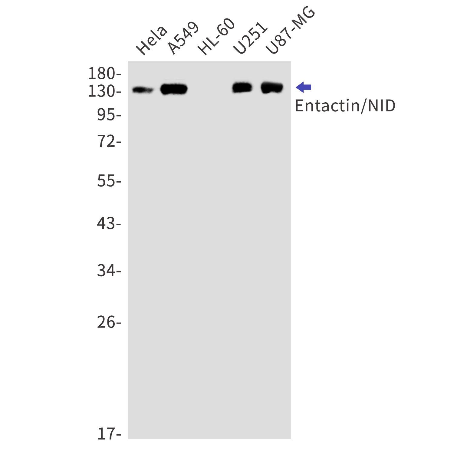Entactin Rabbit mAb