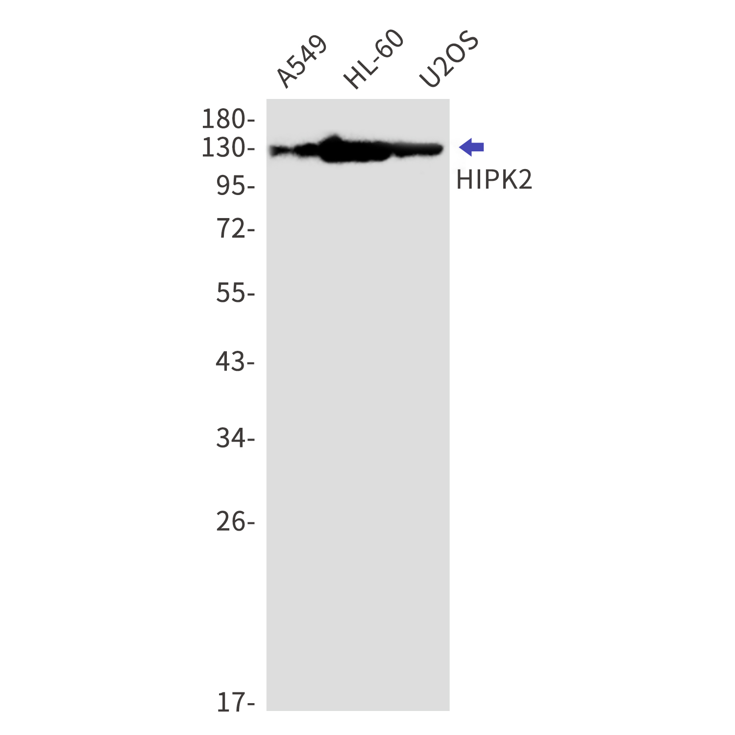 HIPK2 Rabbit mAb