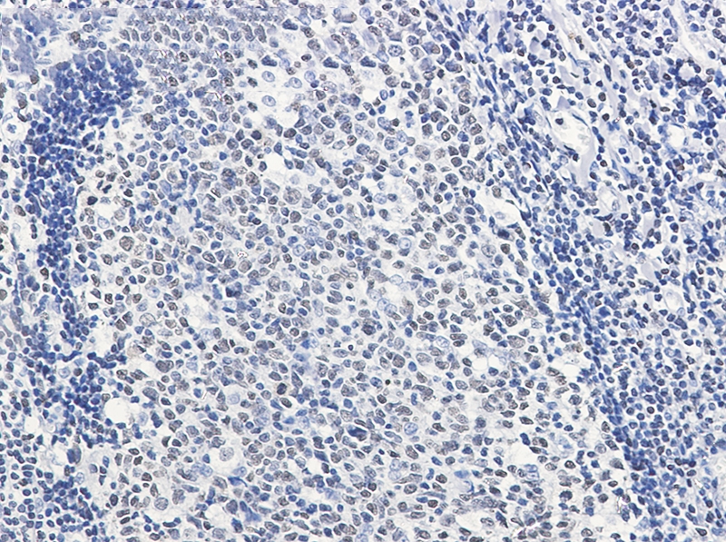 HMGB2 Rabbit mAb