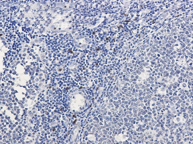 IL 26 Rabbit mAb