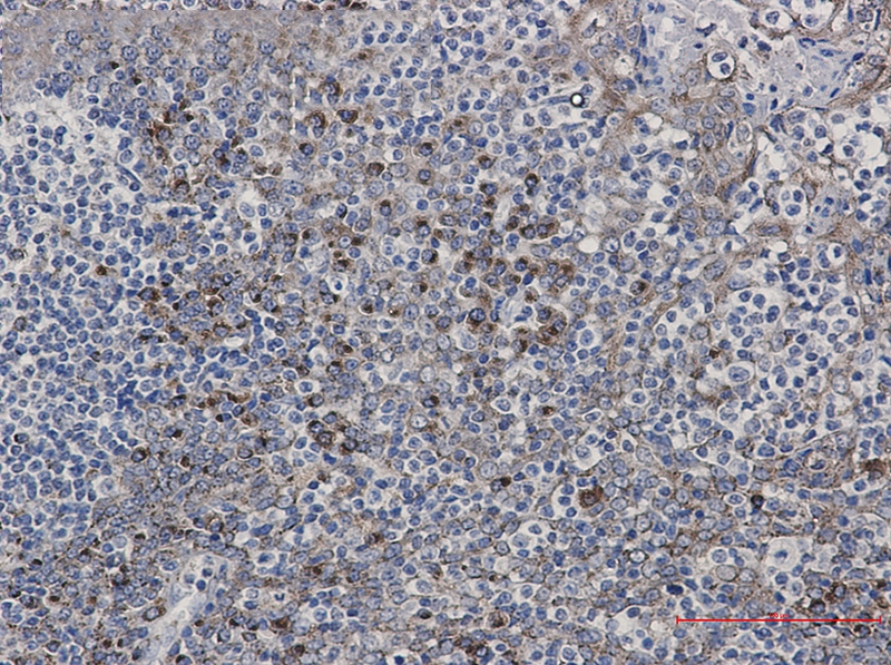 LMAN1 Rabbit mAb