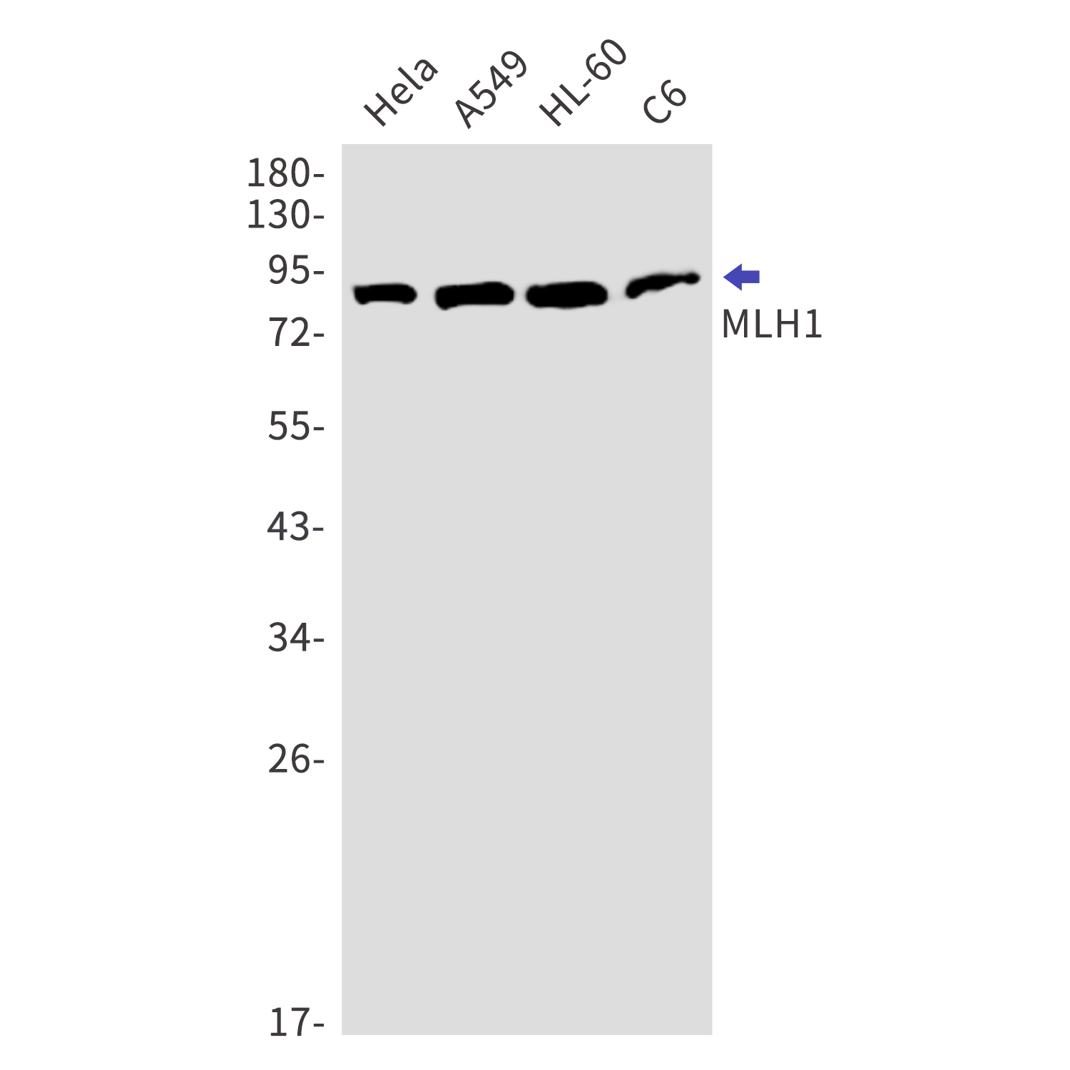 MLH1 Rabbit mAb