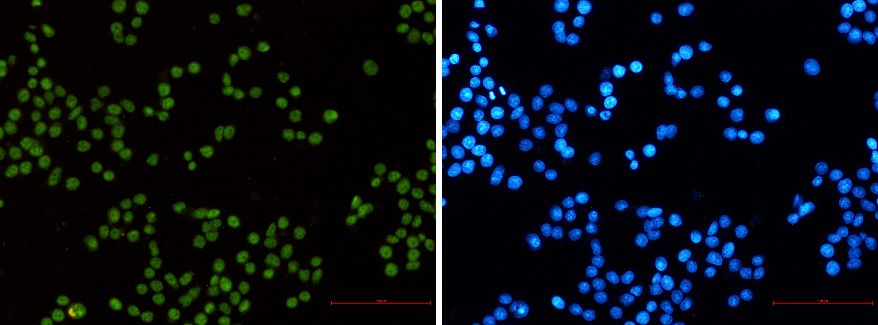 MLH1 Rabbit mAb