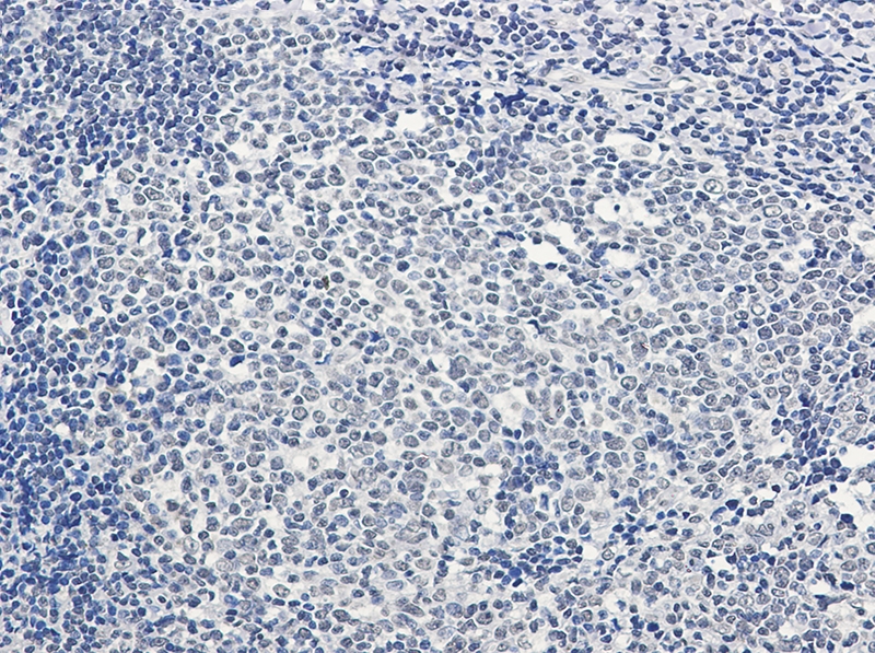 PTBP1 Rabbit mAb