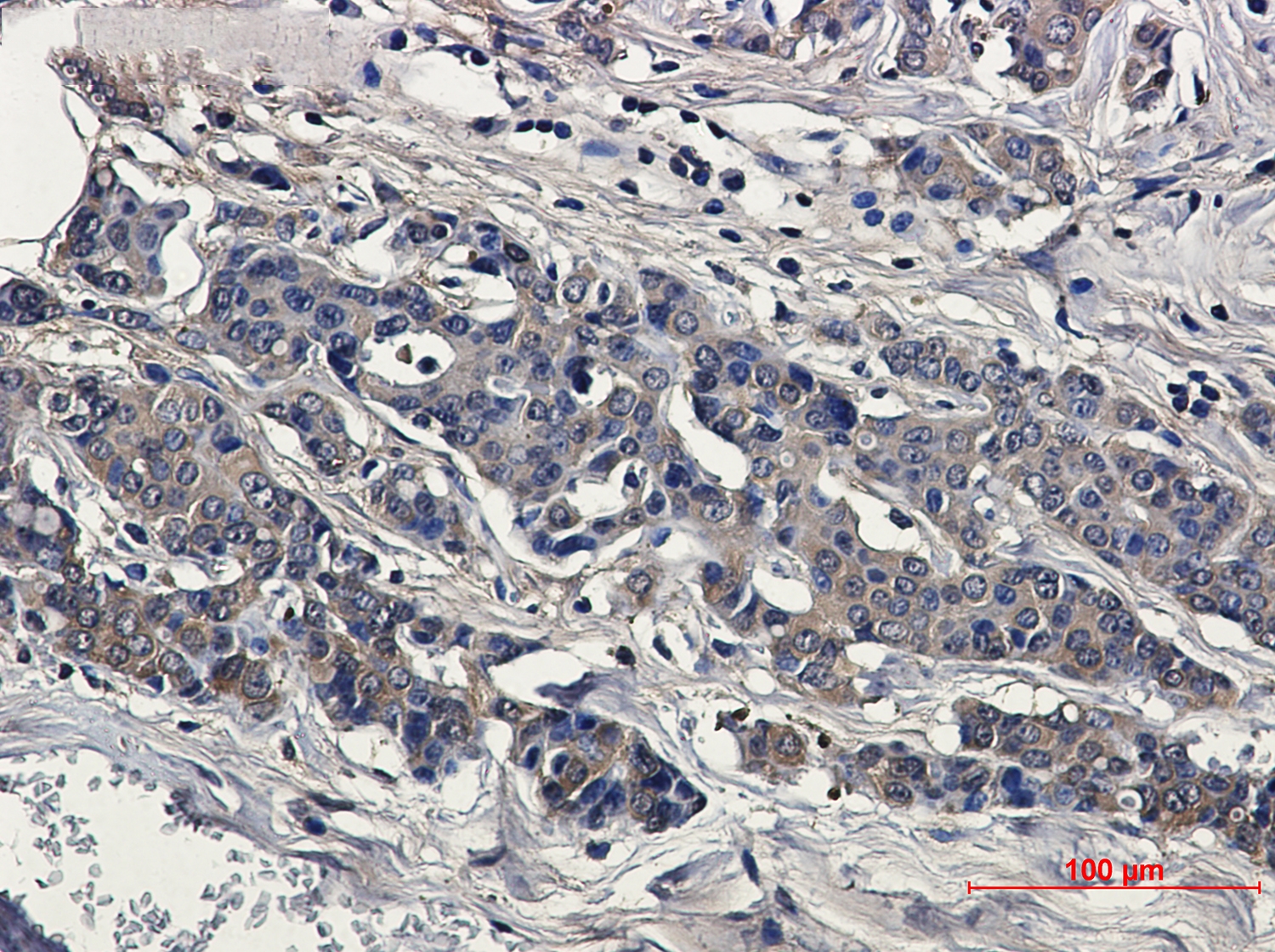 Superoxide Dismutase 1 Rabbit mAb