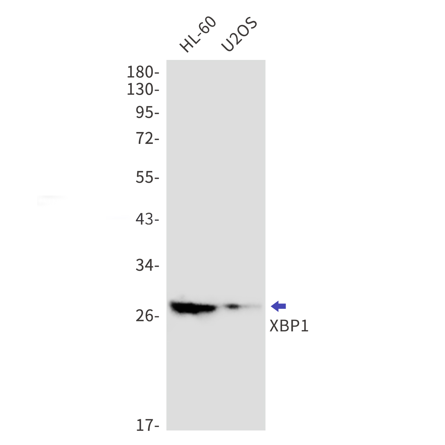 XBP1 Rabbit mAb