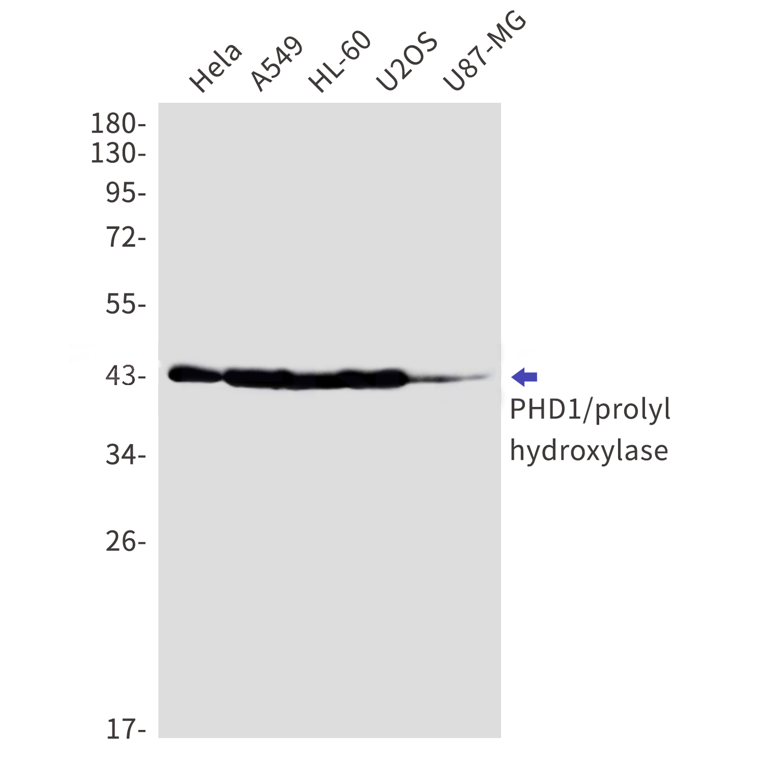 PHD1 Rabbit mAb