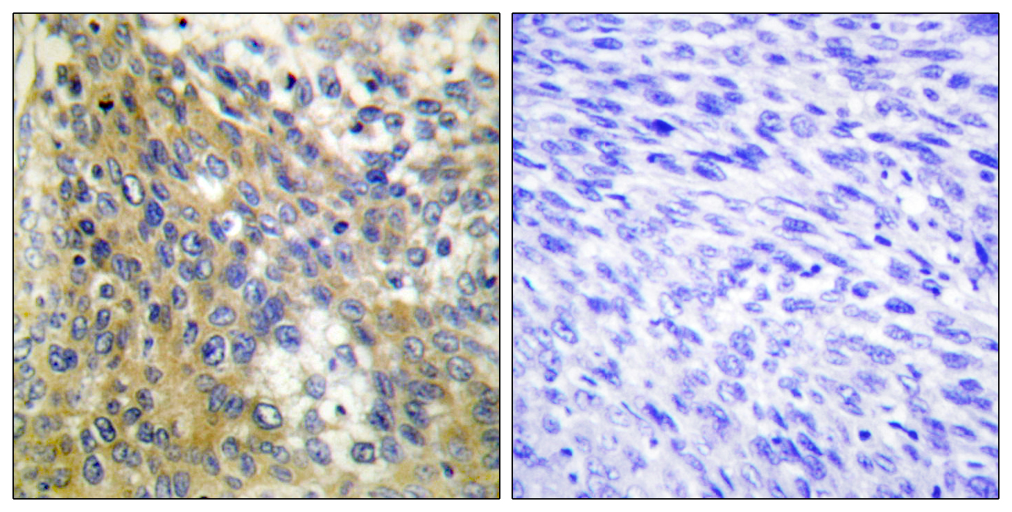 COL4A6 Polyclonal Antibody