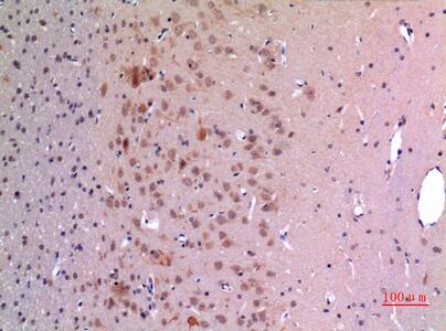 GDF-5 Polyclonal Antibody