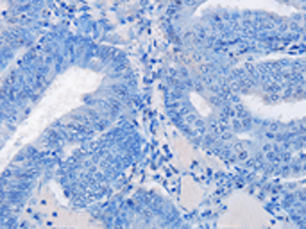 REG3G rabbit polyclonal antibody