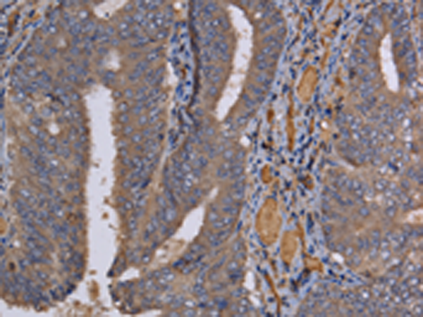 REG3G rabbit polyclonal antibody