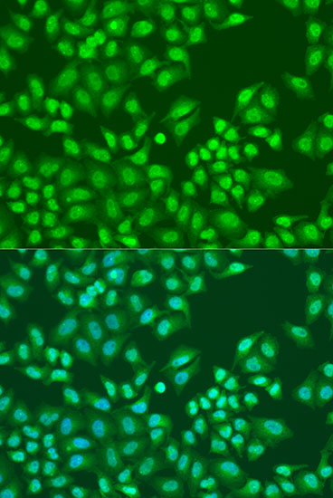 PTEN Rabbit Polyclonal Antibody