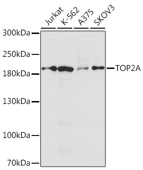 TOP2A Rabbit Polyclonal Antibody