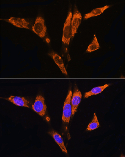 C17orf74 Rabbit Polyclonal Antibody