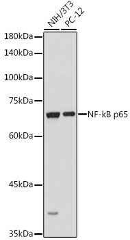 NF-kB p65 Rabbit Polyclonal Antibody
