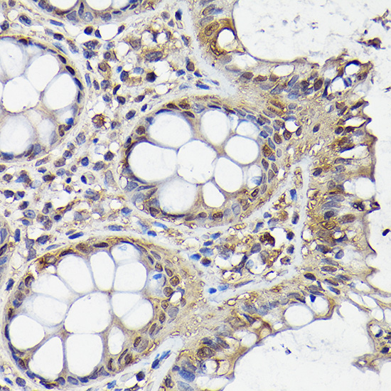 NF-kB p65 Rabbit Polyclonal Antibody