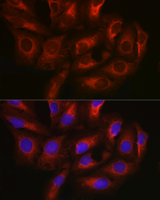 NF-kB p65 Rabbit Polyclonal Antibody