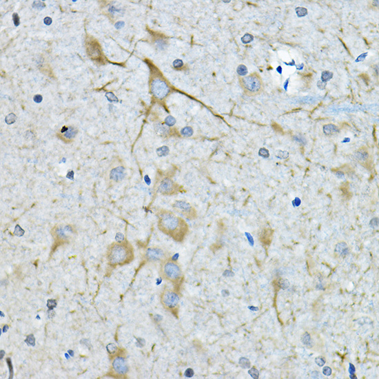 C5orf52 Rabbit Polyclonal Antibody