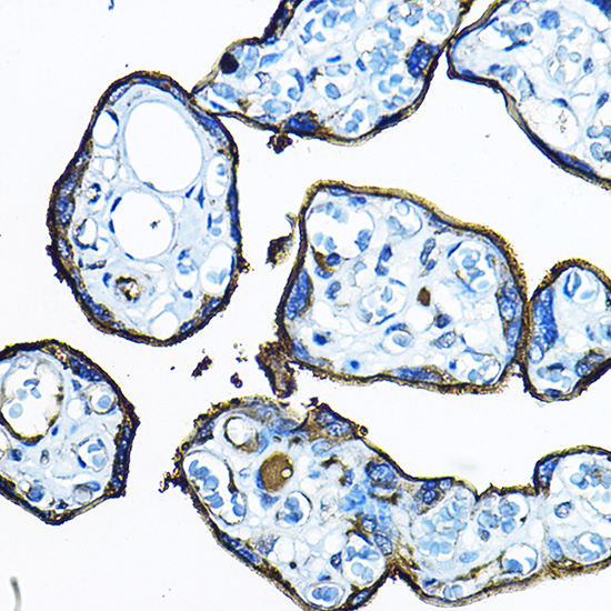C5orf52 Rabbit Polyclonal Antibody