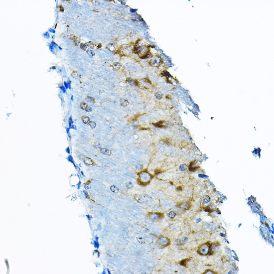 C5orf52 Rabbit Polyclonal Antibody