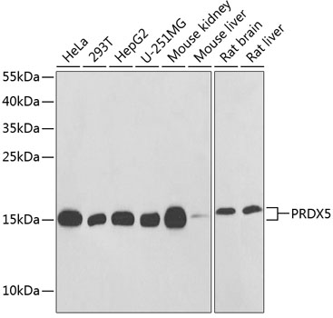 PRDX5 Rabbit Polyclonal Antibody