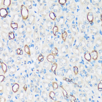 AQP2 Rabbit Polyclonal Antibody