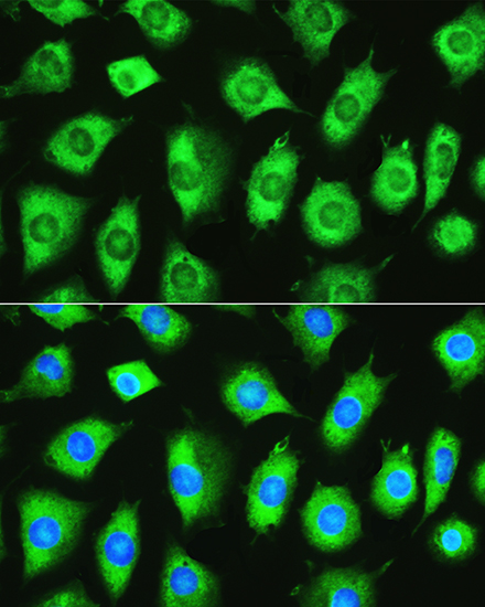 YTHDF1 Rabbit Polyclonal Antibody