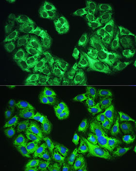 YTHDF1 Rabbit Polyclonal Antibody