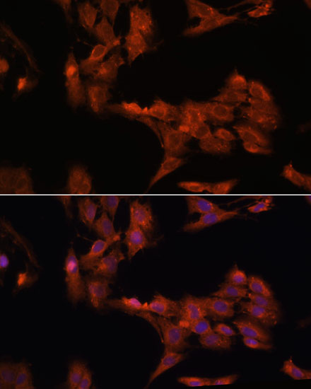 PDK4 Rabbit Polyclonal Antibody