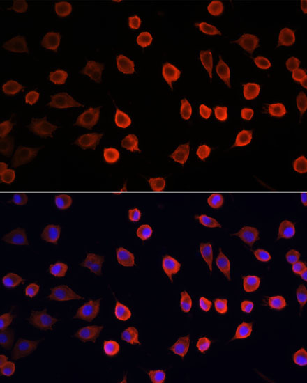 PDK4 Rabbit Polyclonal Antibody