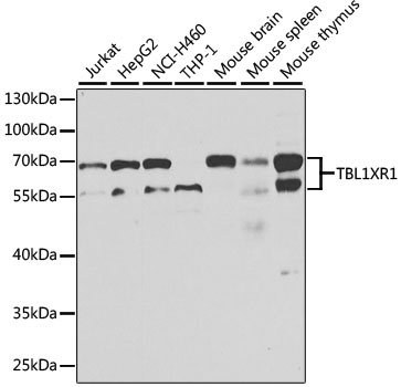 TBL1XR1 Rabbit Polyclonal Antibody