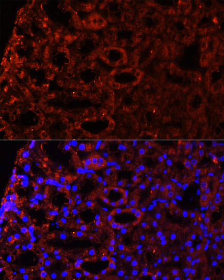 COL20A1 Rabbit Polyclonal Antibody