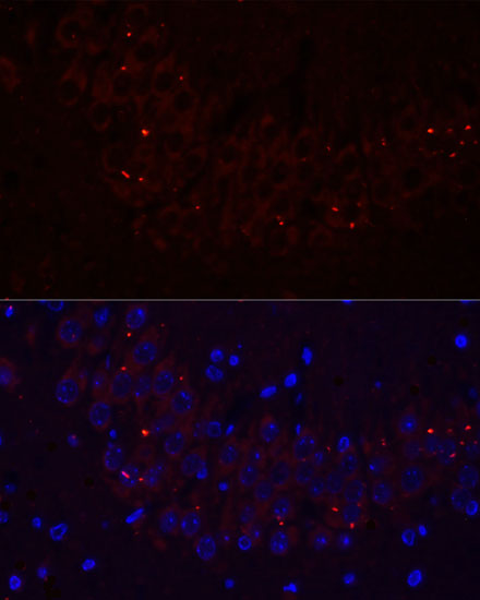 COL20A1 Rabbit Polyclonal Antibody