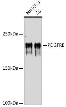 PDGFRB Rabbit Polyclonal Antibody