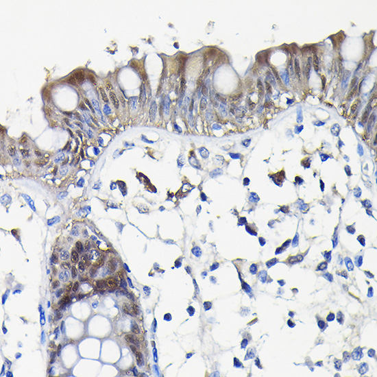 LGALS3 Rabbit Polyclonal Antibody