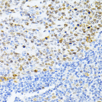 DNMT1 Rabbit Polyclonal Antibody