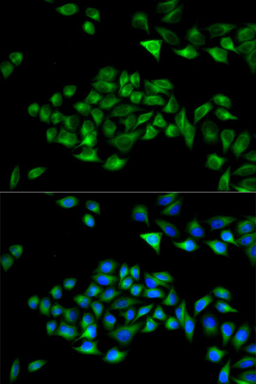 PCM1 Rabbit Polyclonal Antibody