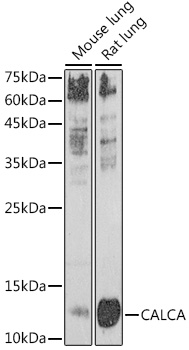 CALCA Rabbit Polyclonal Antibody