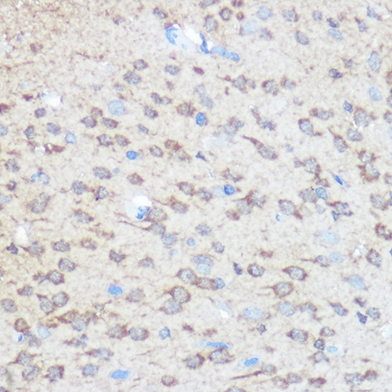 HTT Rabbit Polyclonal Antibody