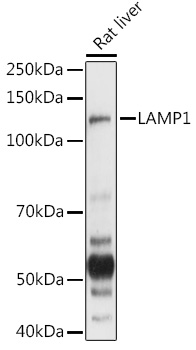 LAMP1 Rabbit Polyclonal Antibody
