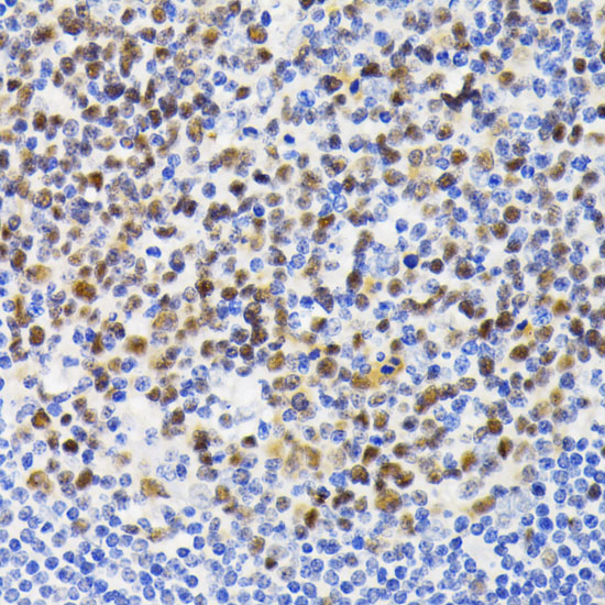 NFATC1 Rabbit Polyclonal Antibody