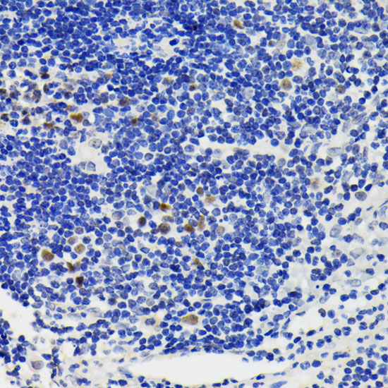 NFATC1 Rabbit Polyclonal Antibody