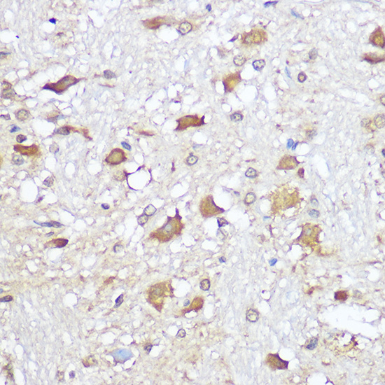 OPRM1 Rabbit Polyclonal Antibody