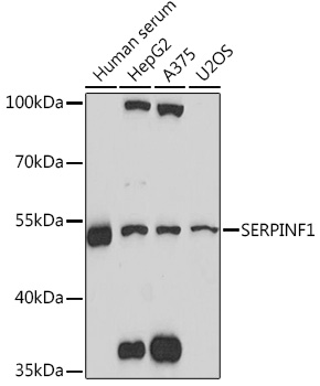 SERPINF1 Rabbit Polyclonal Antibody