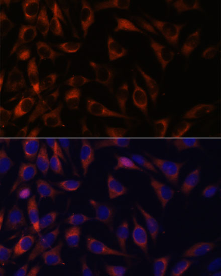 WFDC1 Rabbit Polyclonal Antibody
