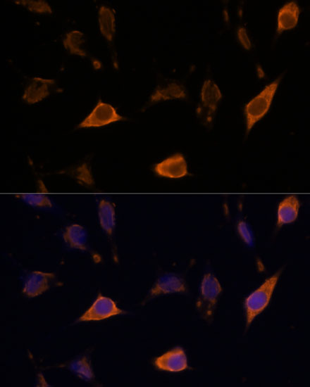 SEMA4A Rabbit Polyclonal Antibody