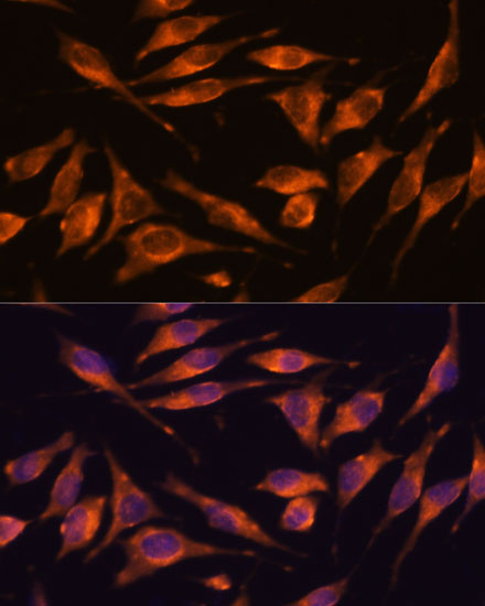 NXN Rabbit Polyclonal Antibody