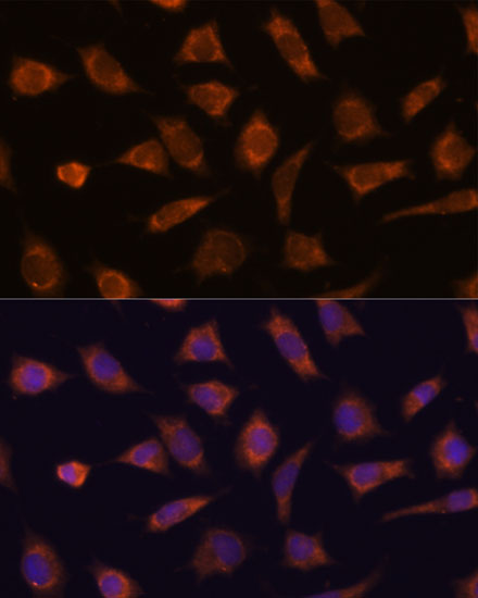CAMSAP1 Rabbit Polyclonal Antibody