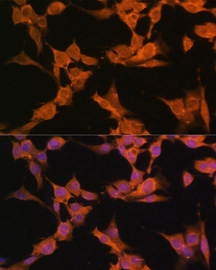 CAMK2A Rabbit Polyclonal Antibody