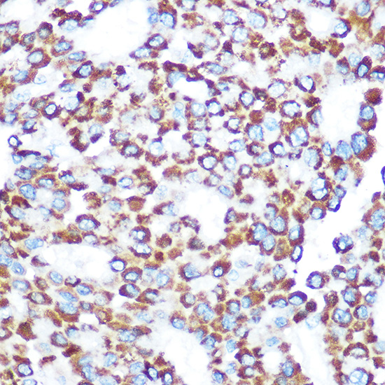 TAB3 Rabbit Polyclonal Antibody